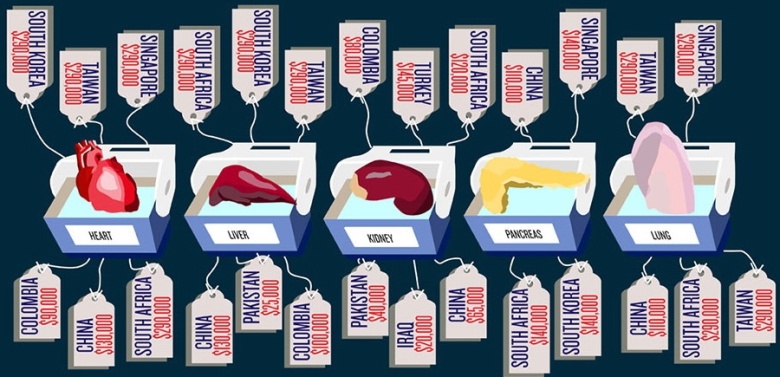 organ-harvesting-cost-chart